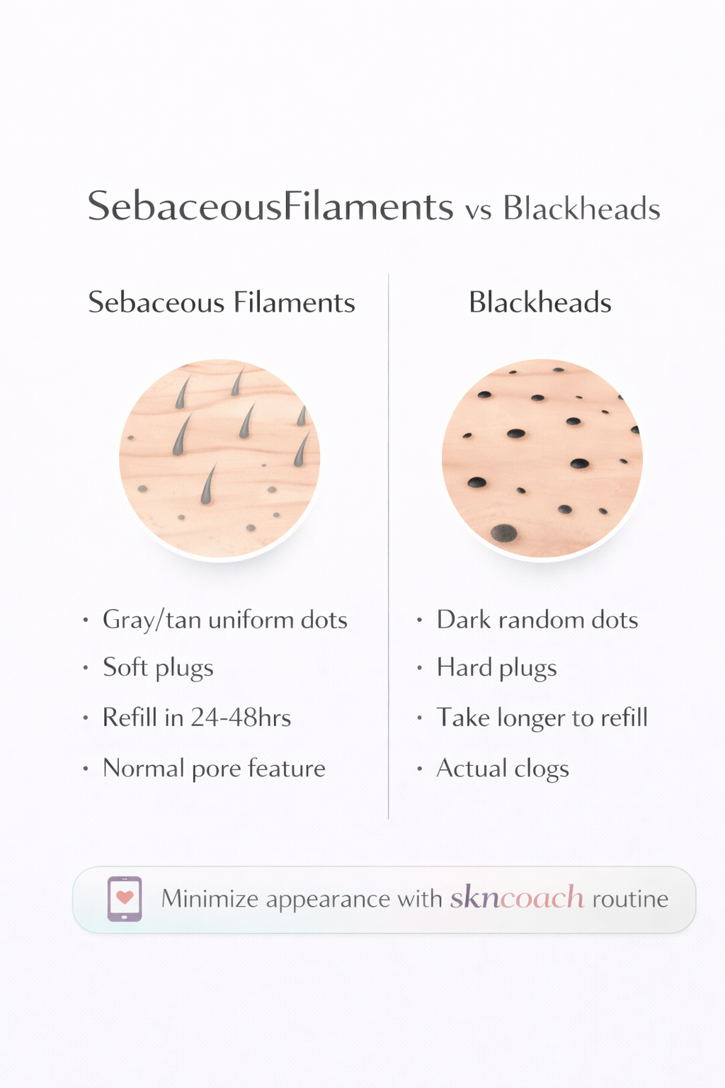 Sebaceous filaments vs blackheads comparison