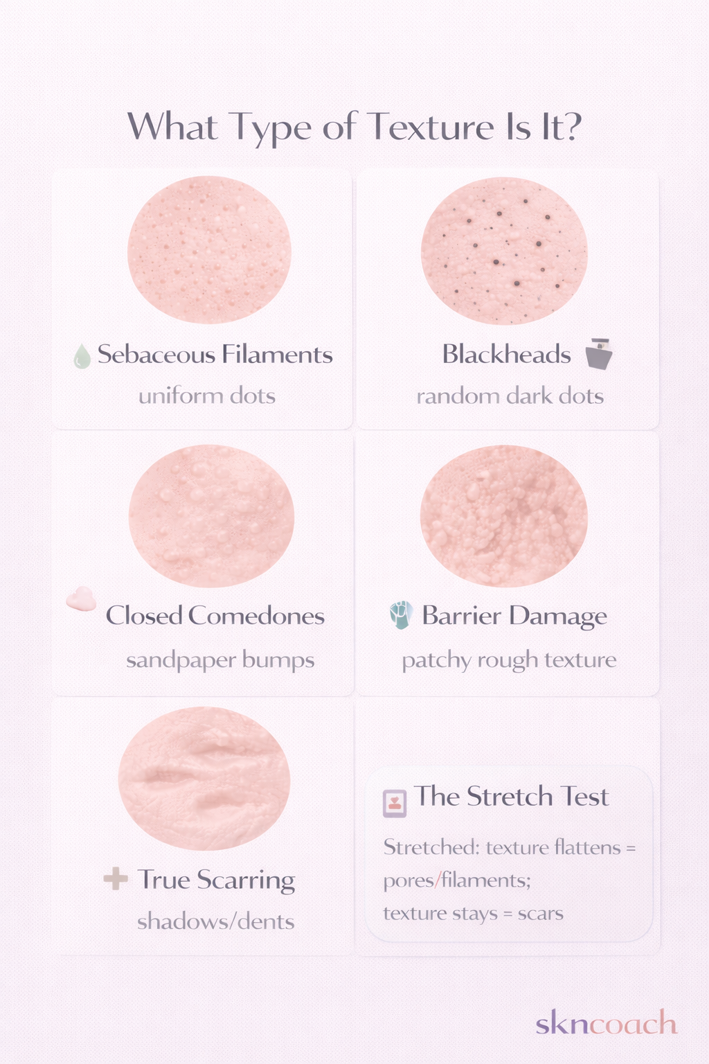 5 types of skin texture - sebaceous filaments, blackheads, comedones, barrier damage, scars