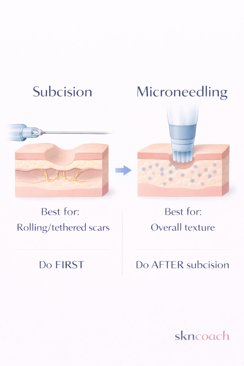 Subcision vs Microneedling - treatment order comparison